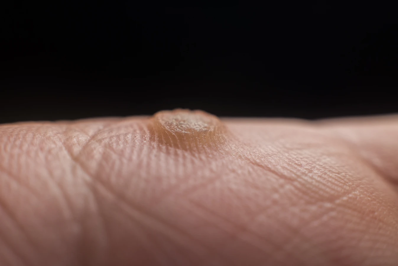 Zadbaj o swoje stopy już dziś - podologia na ratunek